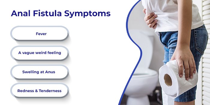 fistula symptoms